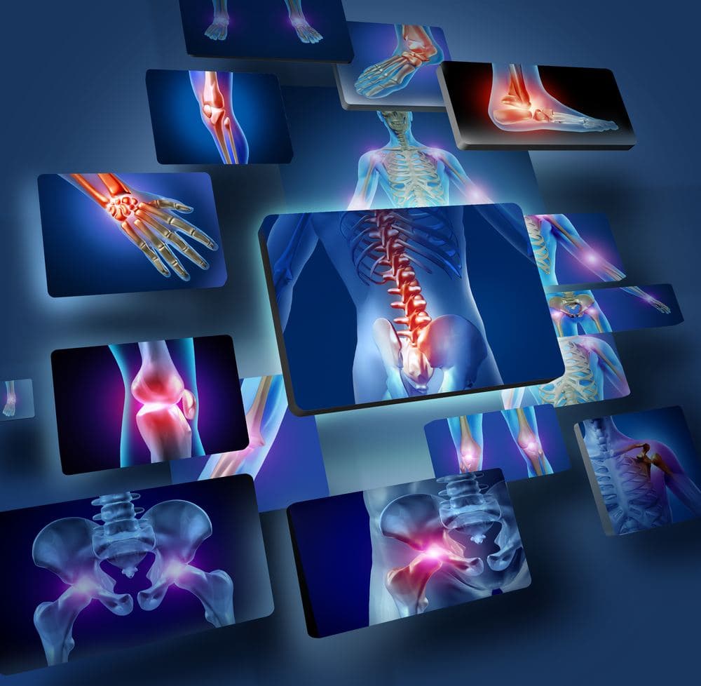 Treating Broken Bones With Chiropractic Care