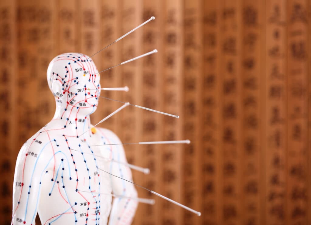 acupuncture Bountiful UT