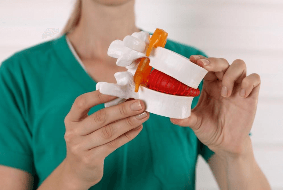 Chiropractor holding a model of a spinal disc, illustrating bulging and herniated disc conditions related to back pain treatment at Elevate Wellness Chiropractic in Bountiful, UT.