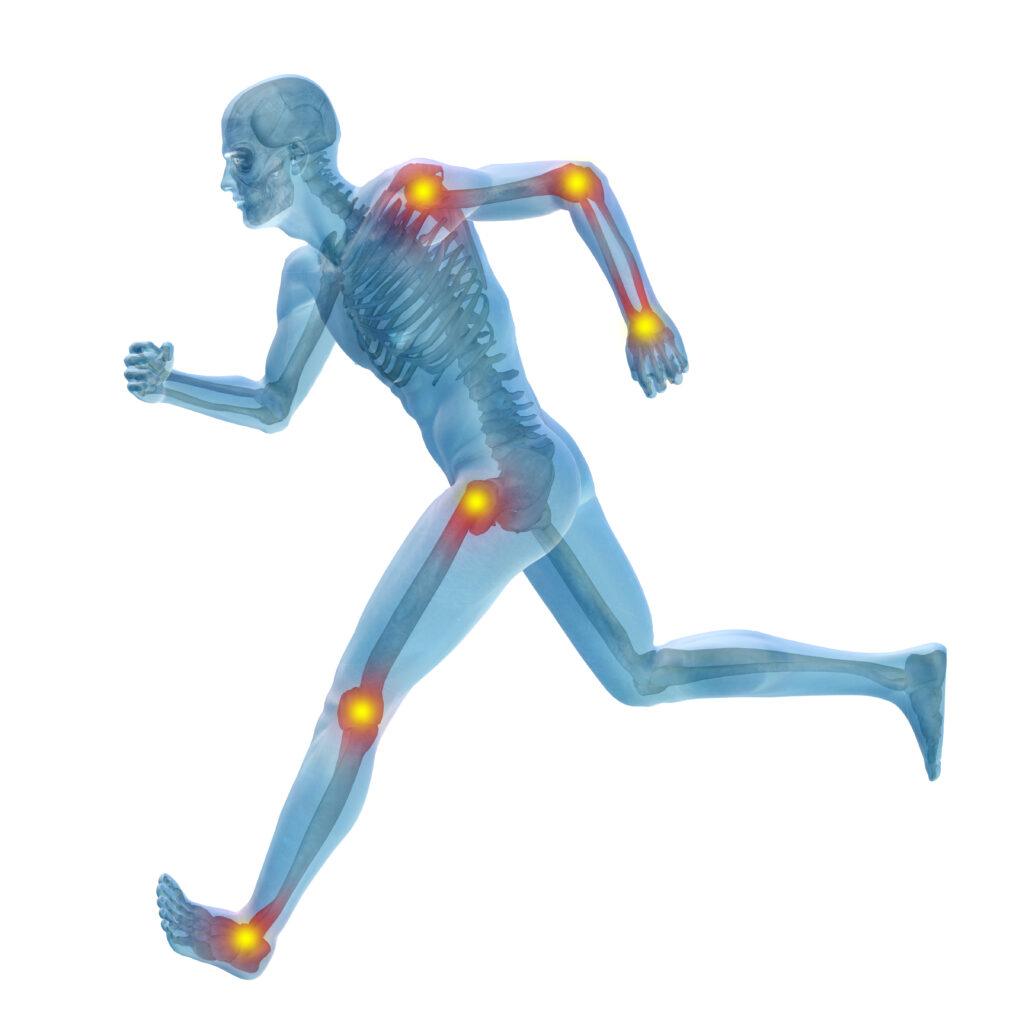 How Does Diet Affect Chiropractic Treatment? How Does Diet Affect Chiropractic Treatment?
