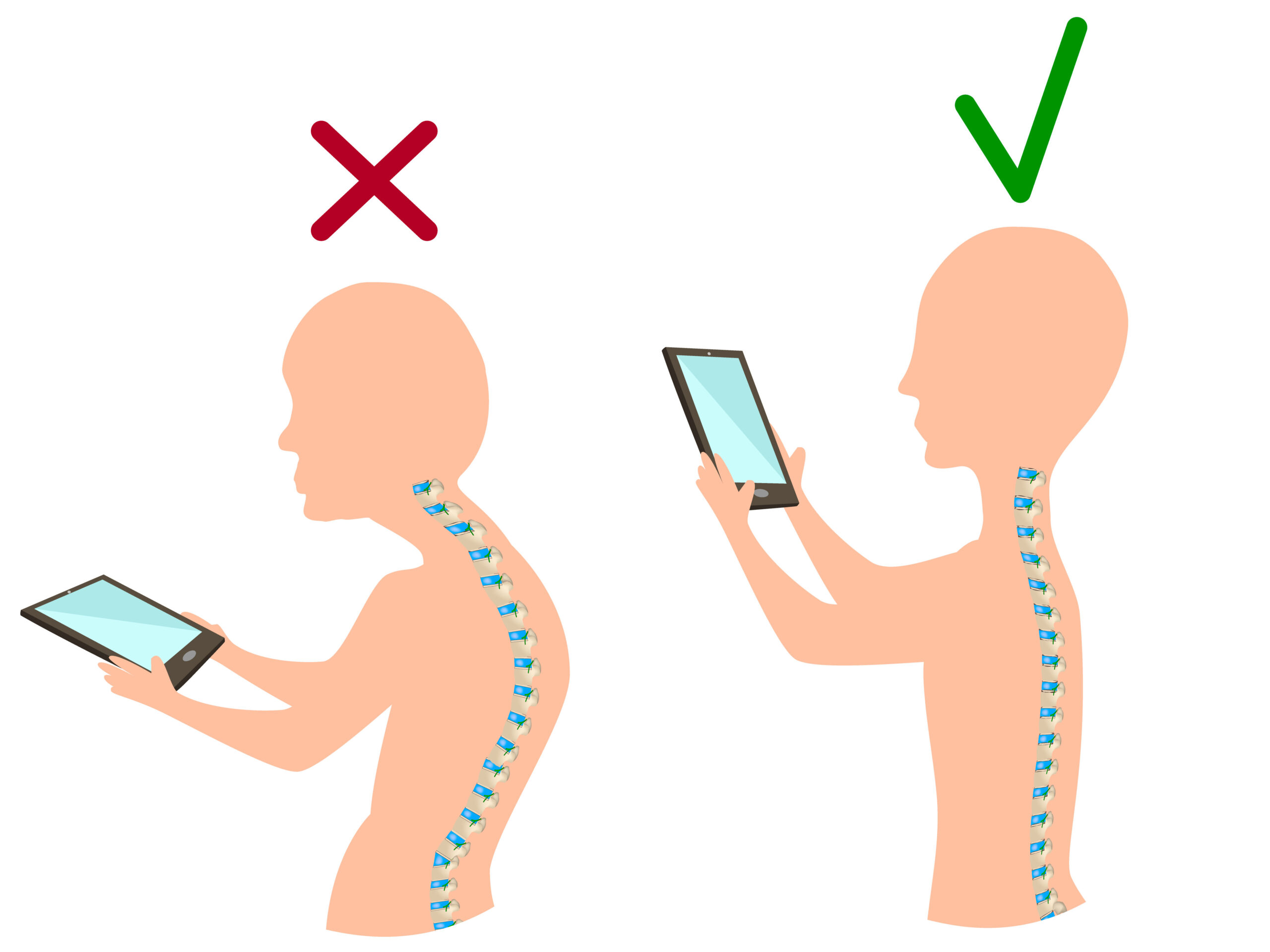Tech Neck: Combating the Strain of Modern Technology
