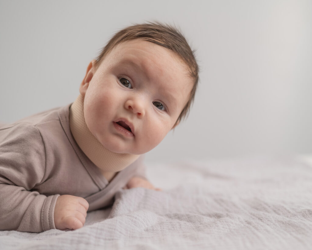 Torticollis: Causes, Symptoms, and the Role of Chiropractic Care